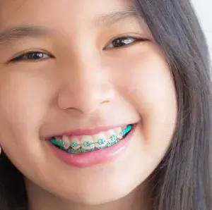 Andros Orthodontics | Orthodontist Pasco, WA | Orthodontist, Ivisalign, Braces, Orthodontic Care