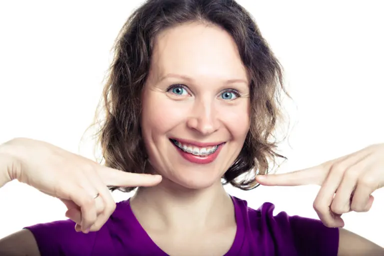 A woman with light brown hair in a purple shirt smiles and points at her adult braces, showcasing her results from Andros Orthodontics in Pasco, WA, against a white background.