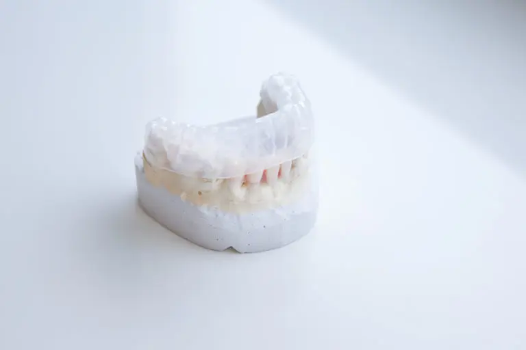 A dental mold of upper teeth with a clear aligner placed on top illustrates a common problem Invisalign can solve—available at Andros Orthodontics in Pasco, WA—set against a white surface.