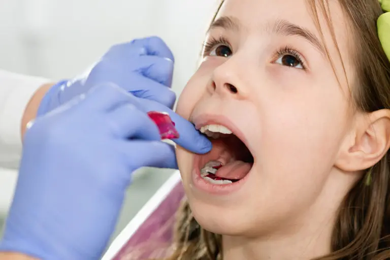 At Andros Orthodontics in Pasco, WA, a dentist wearing blue gloves applies dental sealant to a young girl's molar, preparing her smile for braces.