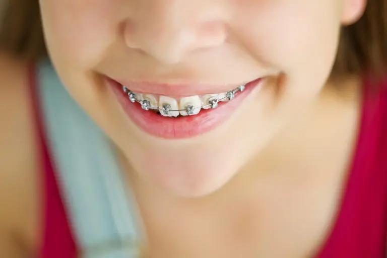 Smiling and showing off metal braces, a young person in a red top with a light blue overall strap highlights how orthodontic care is now more affordable for all at Andros Orthodontics in Pasco, WA.