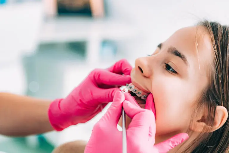 At Andros Orthodontics in Pasco, WA, a dental professional in pink gloves assists a young girl with adjusting to braces during her orthodontic visit.