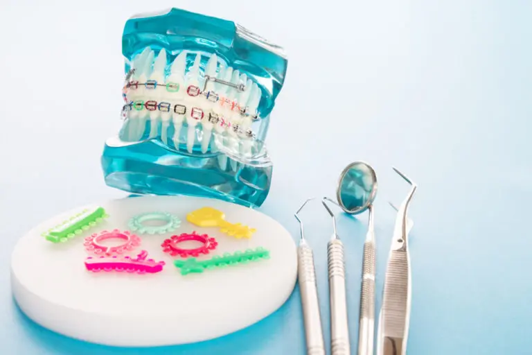 A dental model with braces, colorful bands, and dental tools is shown on a white and blue surface at Andros Orthodontics in Pasco, WA, demonstrating how to handle orthodontic emergencies involving damaged braces.