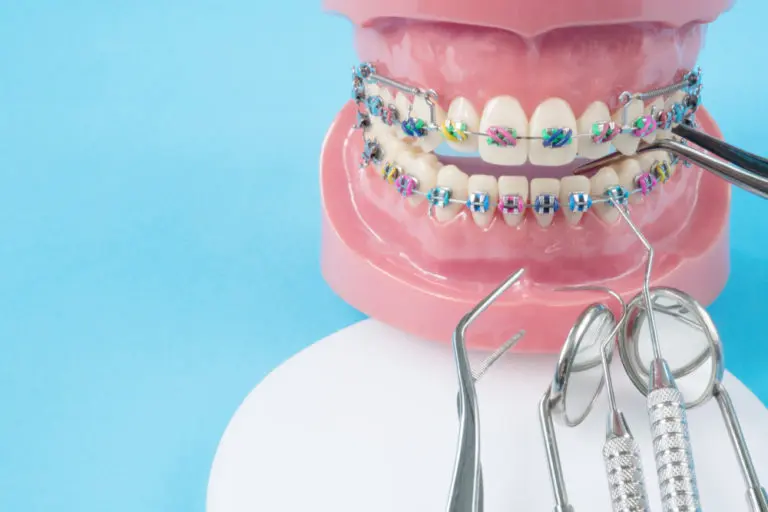 A dental model with colorful braces and various orthodontic tools are displayed on a blue background at Andros Orthodontics in Pasco, WA.