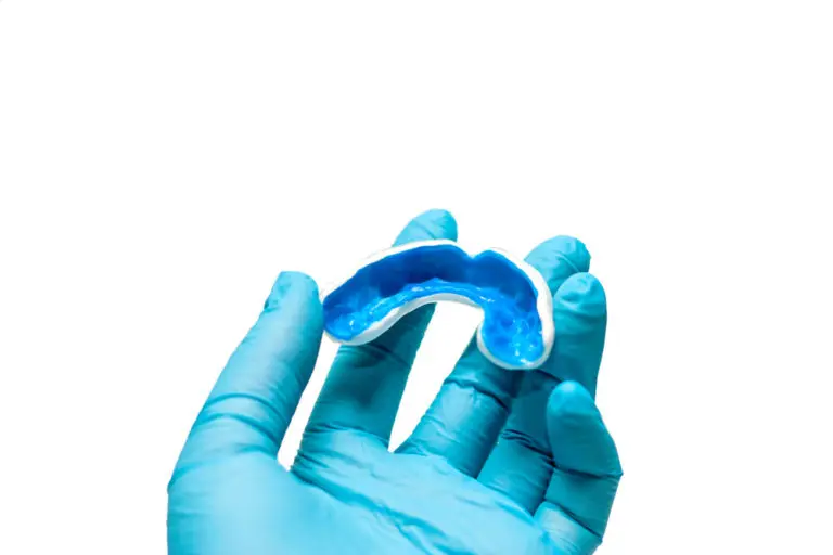 A blue dental impression tray is held by a gloved hand against a white background at Andros Orthodontics in Pasco, WA.
