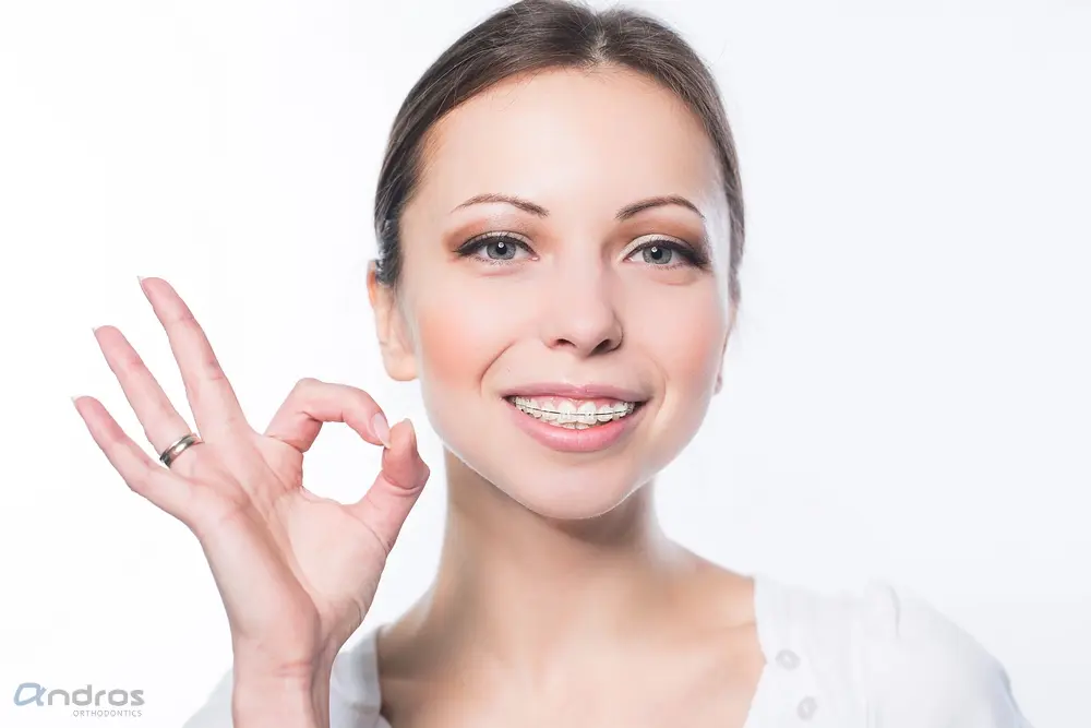 woman with teeth clear braces - How Long Do Braces Take in Pasco, WA 