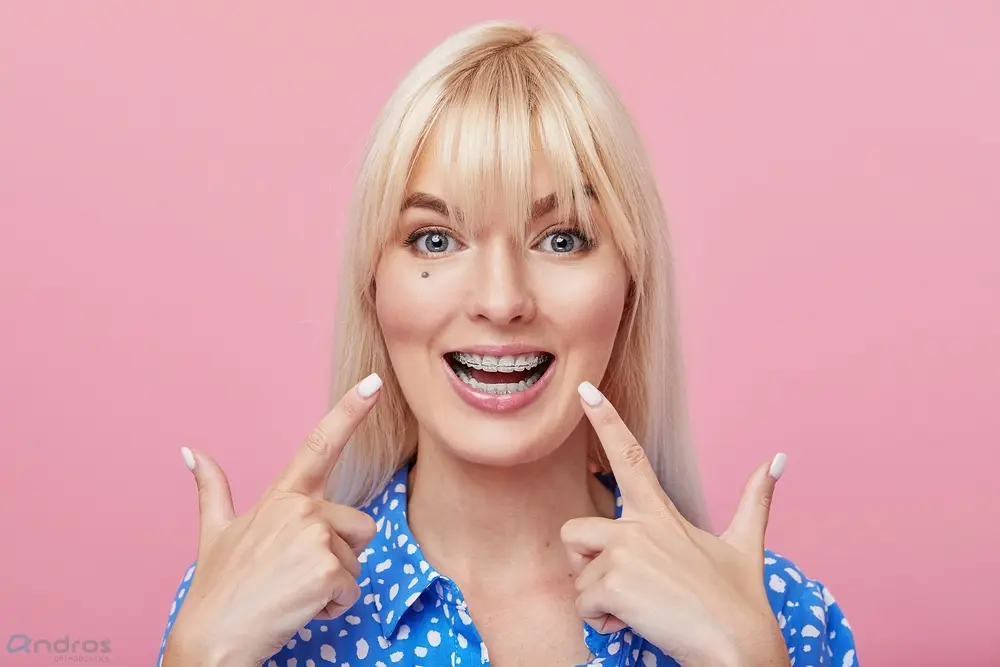 cheerful happy young woman blonde hair gesturing thumb while pointing clear braces - Clear Braces vs Metal Braces in Pasco, WA