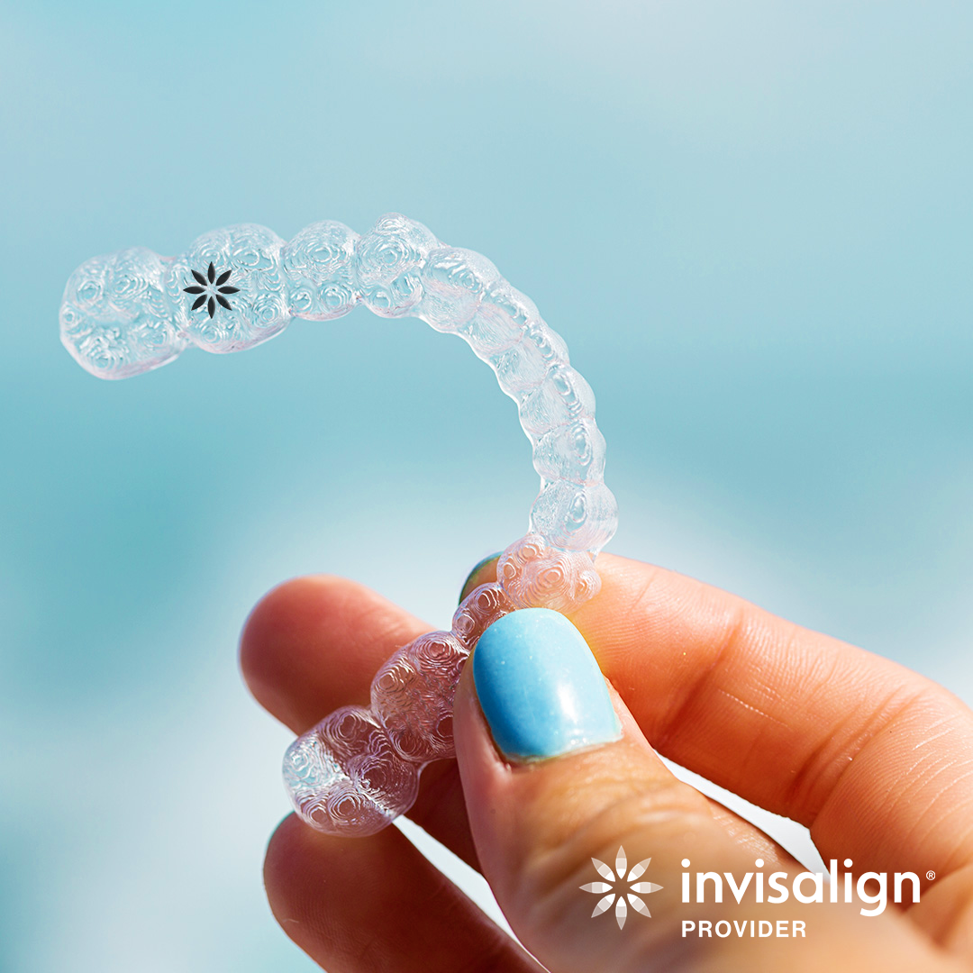 Illustration of Invisalign aligners
