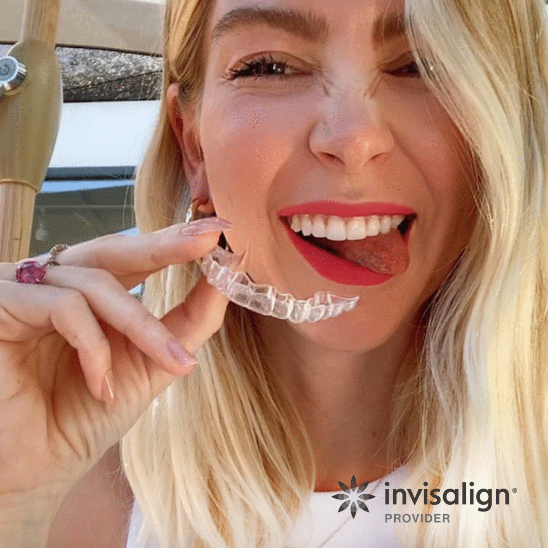 Illustration of Invisalign treatment duration