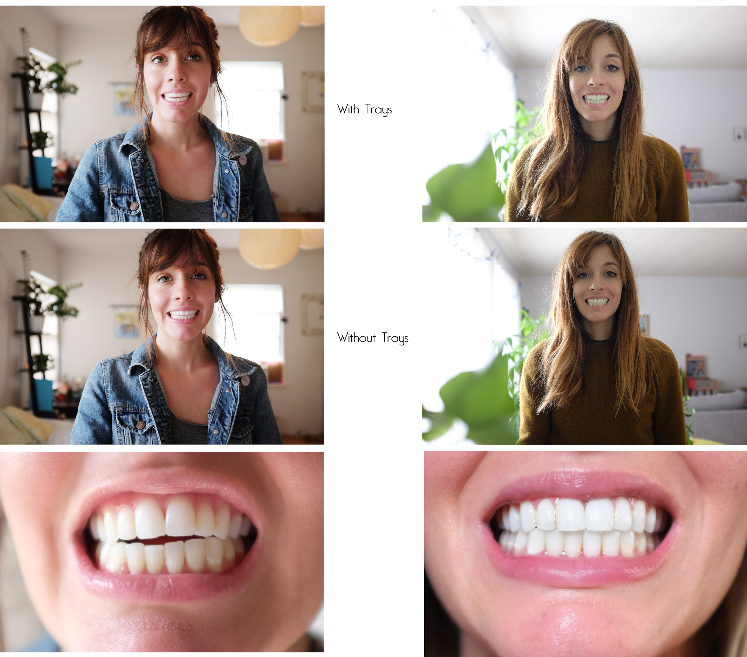 Illustration of orthodontic issues