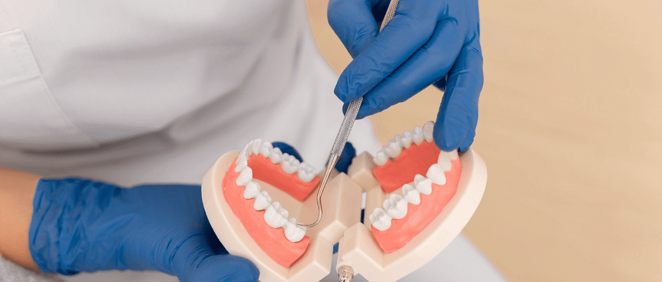 At Andros Orthodontics in Pasco, WA, a person in blue gloves uses a dental tool on a model of human teeth and gums to demonstrate overbite examination.