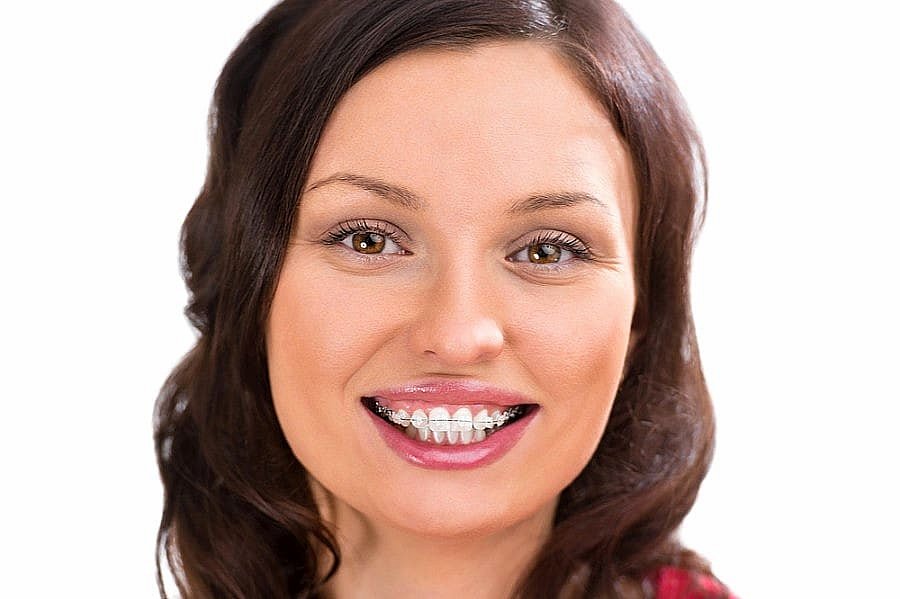 A woman with long brown hair, wearing ceramic braces and smiling against a plain white background, represents the confident results achieved at Andros Orthodontics in Pasco, WA.