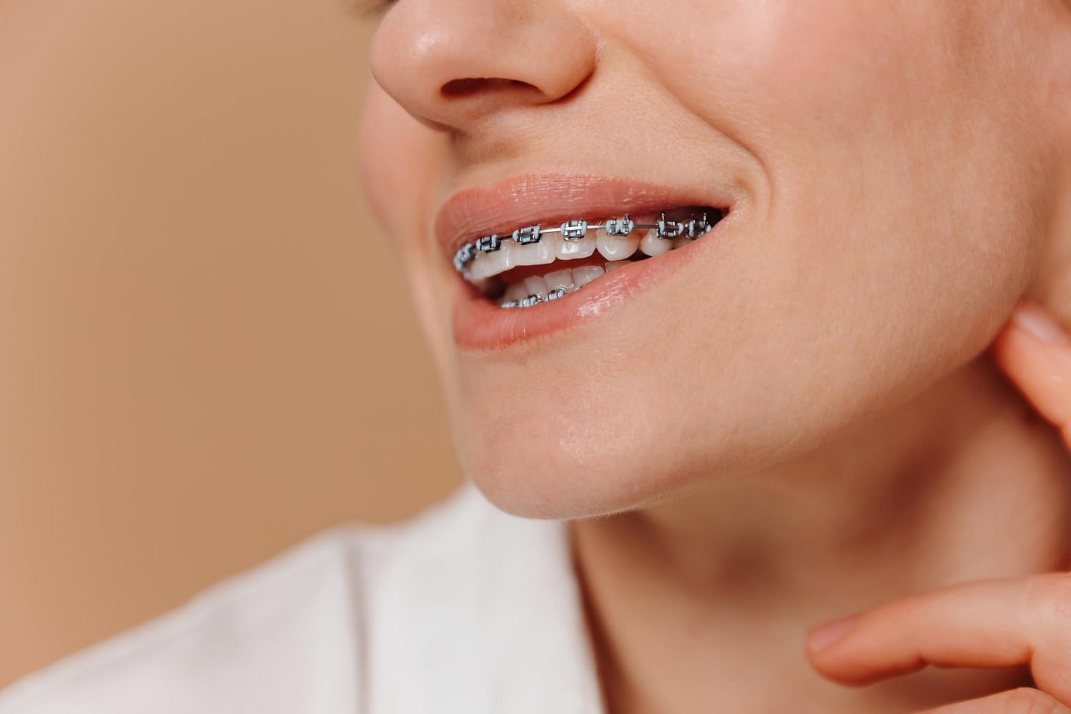 A person gently touches their chin while smiling and displaying metal braces, which correct an overbite—showcasing orthodontic treatment at Andros Orthodontics in Pasco, WA. The neutral background keeps the focus on their smile.
