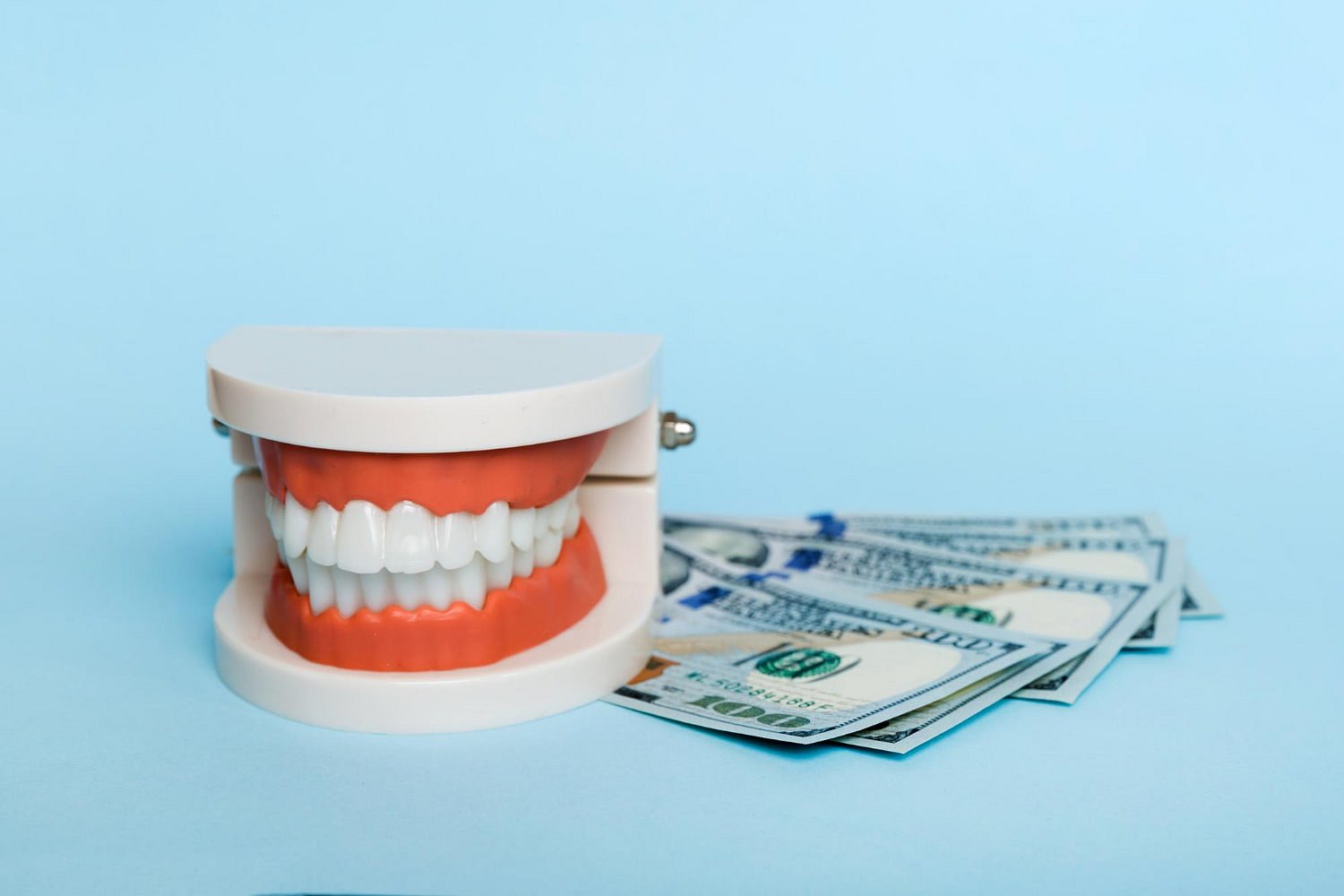 A dental model with artificial teeth and metal braces sits beside several hundred-dollar bills on a light blue background, representing Andros Orthodontics in Pasco, WA.