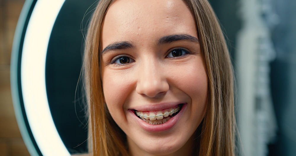 Andros Orthodontics A young person with long straight hair smiles, revealing clear braces, beneath a circular light at Andros Orthodontics in Pasco, WA.