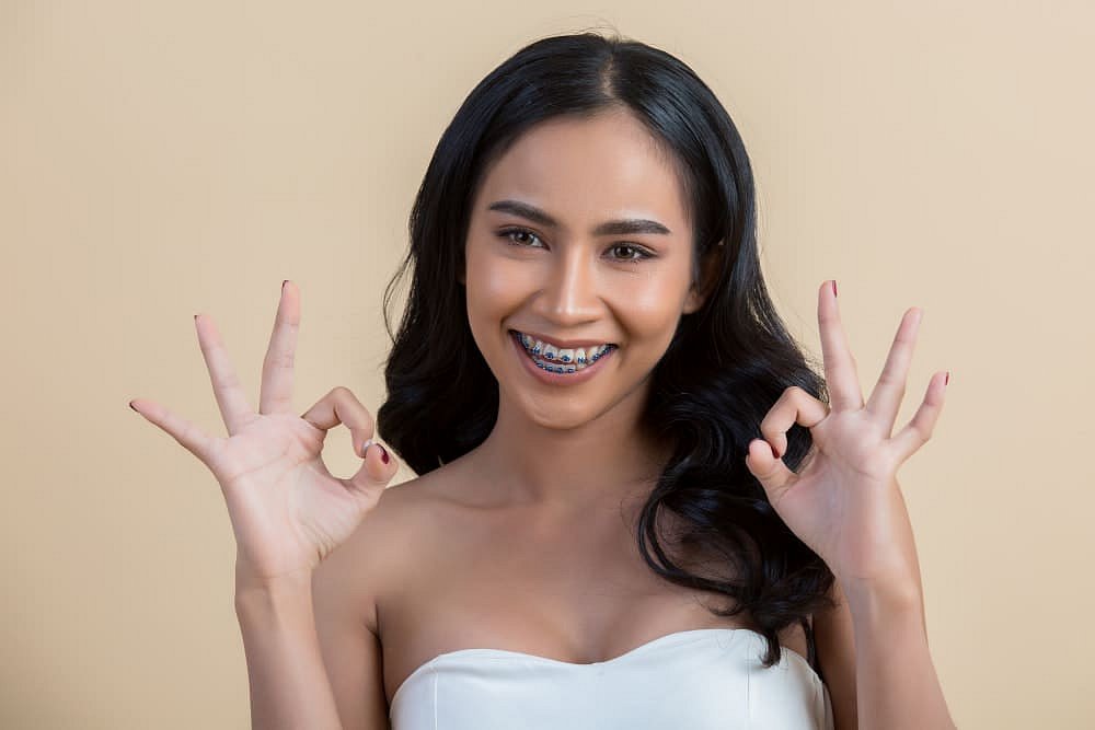 A young woman with long dark hair and braces, highlighting her smile, adult orthodontics, and Overbite treatment at Andros Orthodontics in Pasco, WA, wears a white strapless top and flashes three "OK" hand signs against a beige background.
